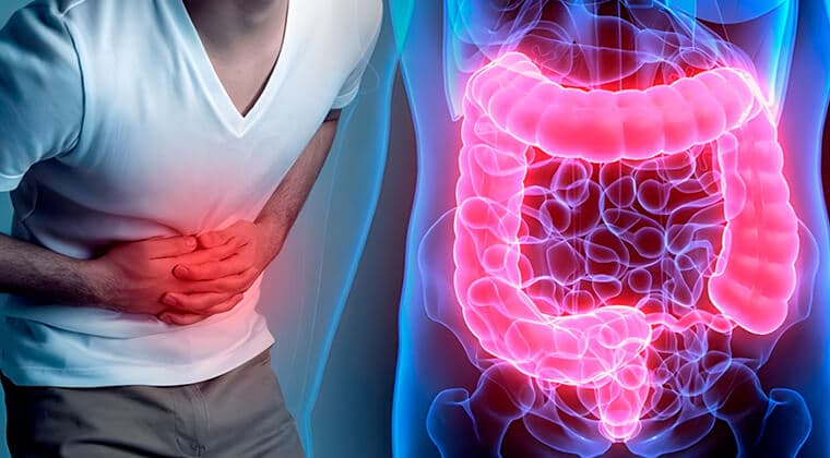 Enfermedad inflamatoria intestinal
