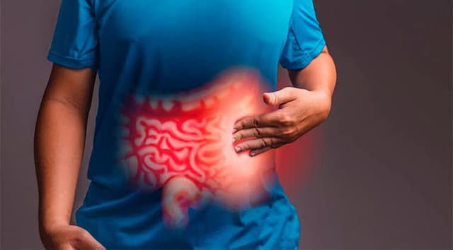 Síndrome del intestino irritable